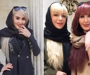 زهره فکورصبور یه پاش تو آرایشگاه یه پاش زیر تیغ عمل زیبایی! +عکس