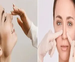 کوچک کردن بینی با خمیردندان / با ترکیب اینجوریش دماغ گوشتی رو تو 1 هفته قده نخود کن