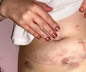 تجاوز وحشیانه به دختر 18 ساله توسط دوست پسر مادرش !