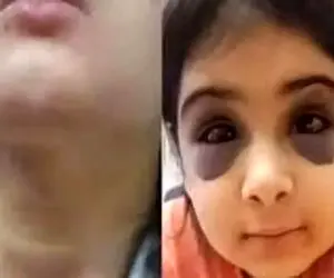 ماچرای شکنجه آنیلا، کودک سنندجی چیست؟ / نتیجه پیگیری های بهزیستی چه شد؟