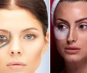 راهکارهای خونگی برای رفع تیرگی زیر چشم / چجوری در منزل سیاهی زیر چشم رو از بین ببریم؟
