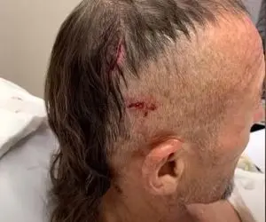 (عکس) سر شناگر شجاع میان آرواره های تمساح گرسنه!