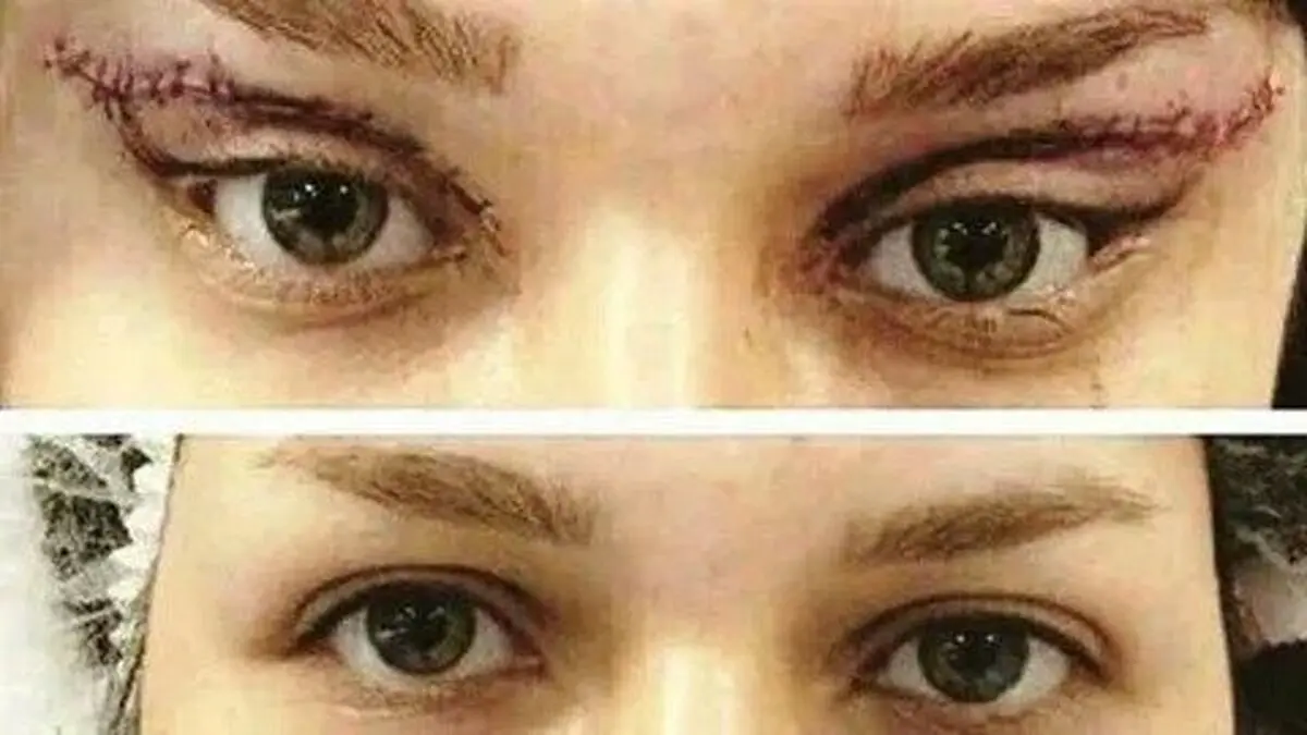 عجیب ترین عمل های زیبایی