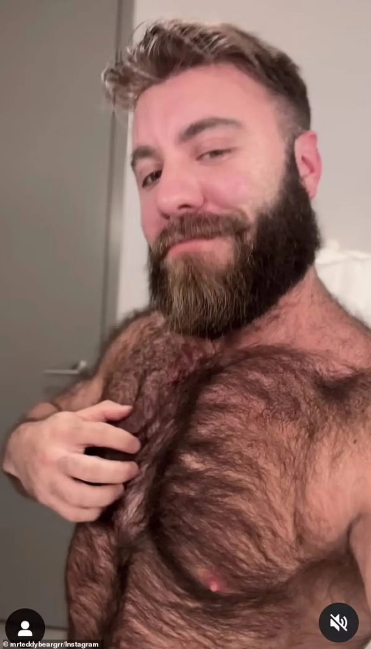 63585371-11326885-He_has_been_growing_body_hair_since_he_was_13_and_it_comes_with_-a-33_1666082479575-585x1024