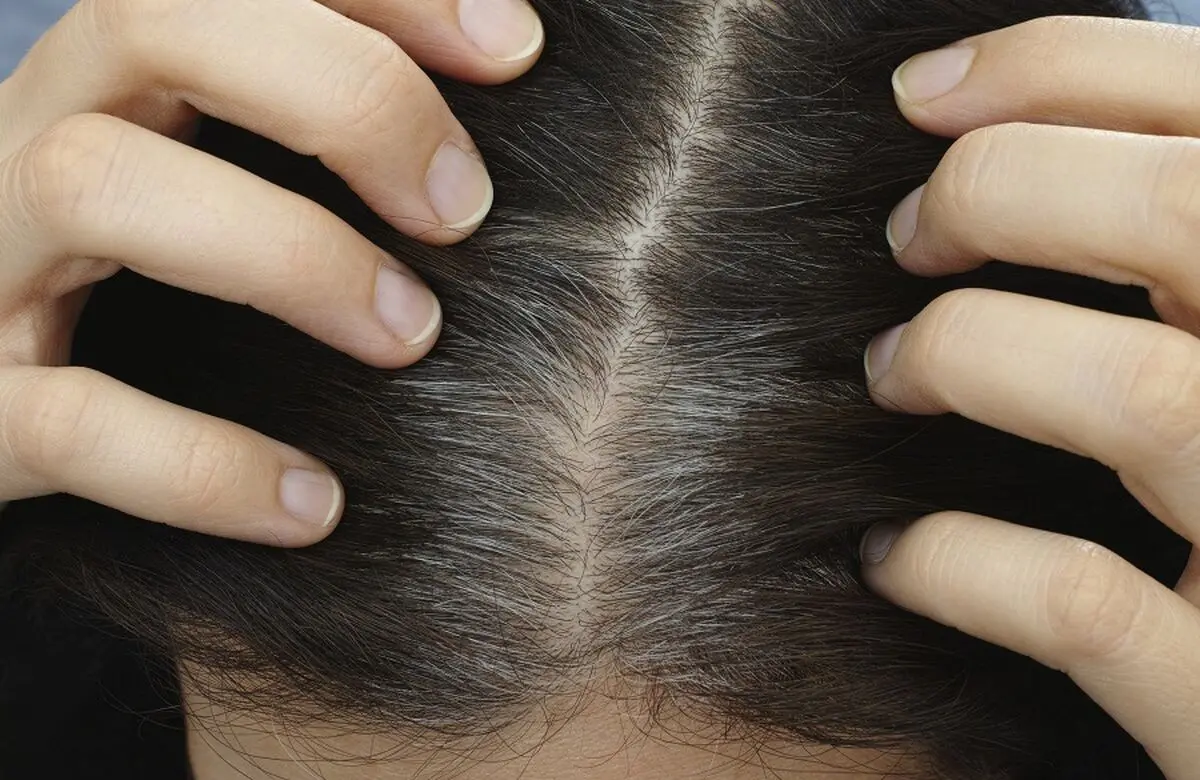 grey-hair