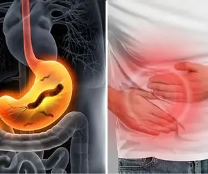 عفونت هلیکوباکتر؛ عفونتی که به جان معده میفتد و نیمی از مردم جهان به آن مبتلا هستند