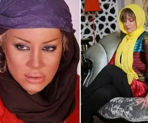 چهره زیر و رو شده "شراره رخام" بعد یه کارای عجیب؛ سنش دایناسوریه فِیسش جوجه ای!