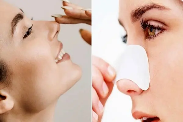 کوچک کردن بینی در خونه با خمیردندون بدون زحمت و دردسر / ارزون، بی خطر و اثربخش