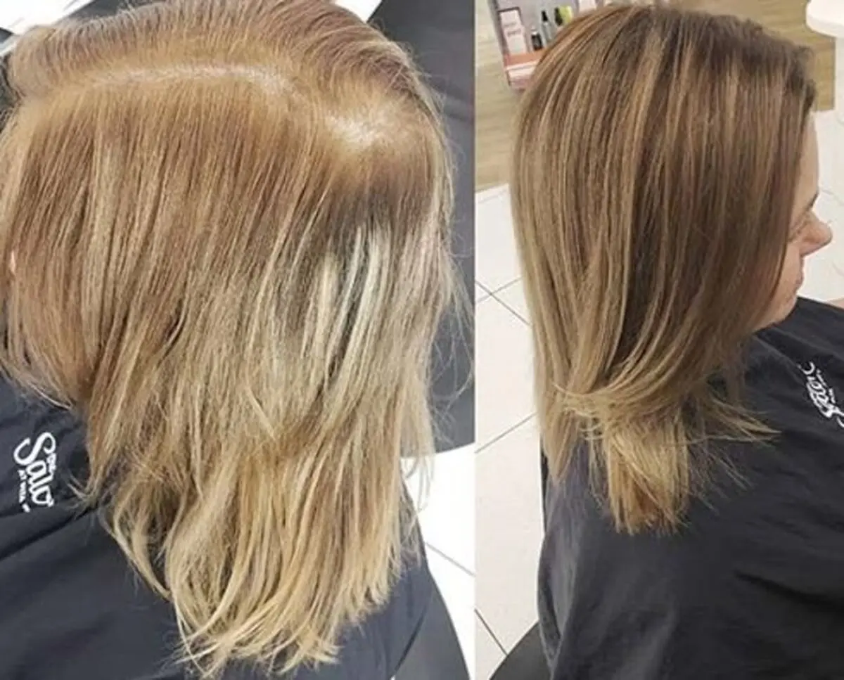999