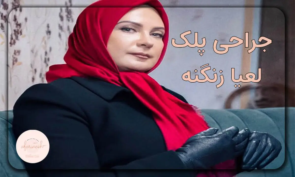 بلفاروپلاستی لعیا زنگنه