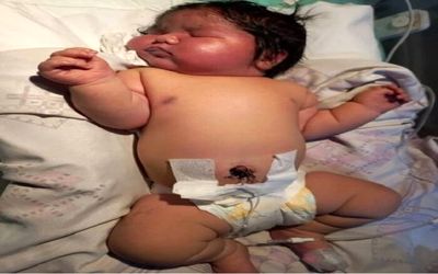 (عکس) تولد نوزاد 6/5 کیلویی به روش طبیعی در مشهد