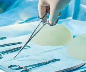 بهترین پزشکهای جراحی سینه در تهران؛ نمونه کارها و صفحات اینستاگرام