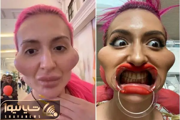 Anastasiia Pokreshchuk shayanews