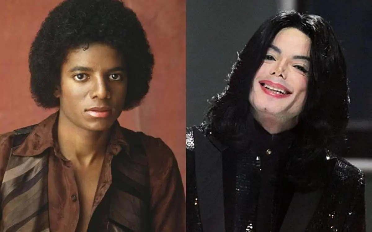 michael-jackson-plastic-surgery-99838