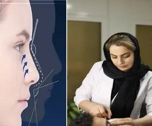 متخصص ترین دکترهای عمل بینی کرج / دارای بالاترین میزان رضایت مراجع در البرز