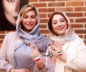 خانم سلبریتی دماغ عملی فقط مانده بود بدنش را برنز کند! +عکس