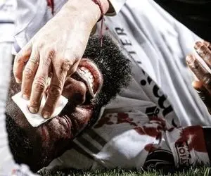 حضور مدافع رئال در ال کلاسیکو با ماسک مخصوص!