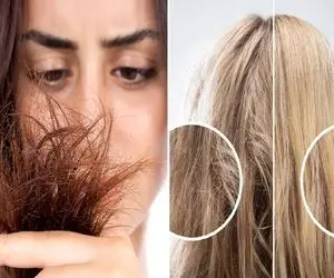 از بین بردن موهای پر از موخوره در یک هفته / اصلا نیازی به کوتاه کردن نداری عاقل باش