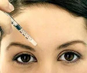 آیا تزریق ژل می تواند خط اخم را بهبود ببخشد؟