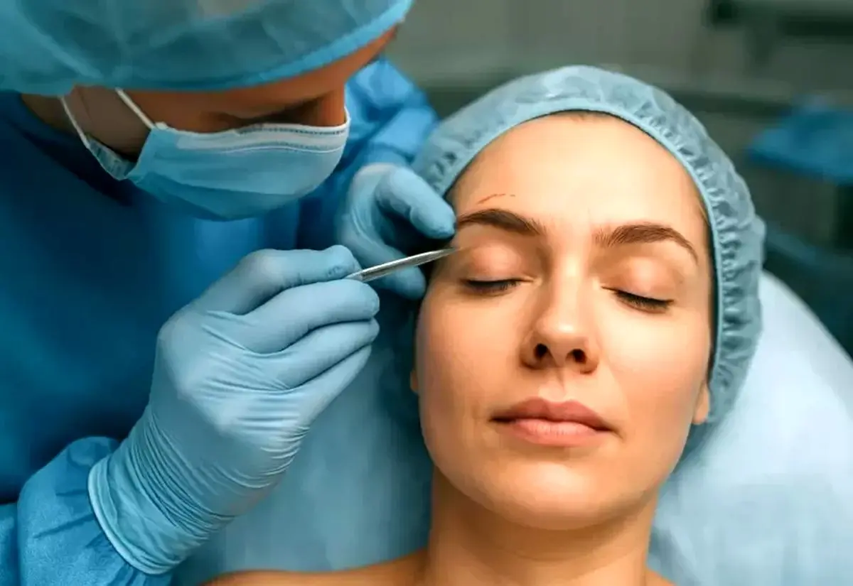 انواع جراحی_های لیفت ابرو - تصویر 3