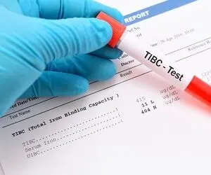 تست TIBC آزمایش خون چیست؟