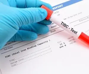 تست TIBC آزمایش خون چیست؟