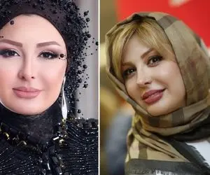 تغییر خفن نیوشا ضیغمی بعد عمل!