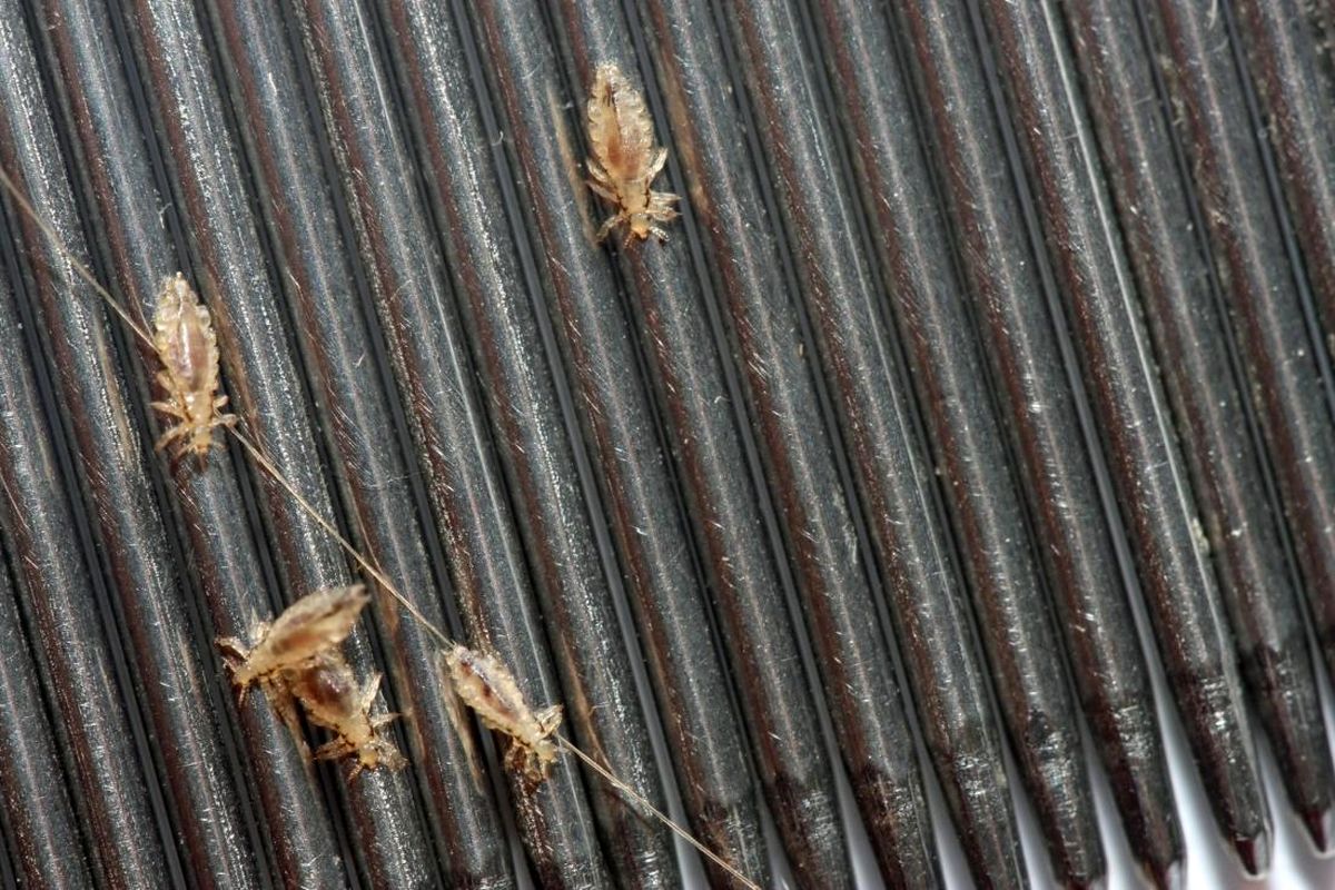 close-up-of-head-lice-on-a-comb