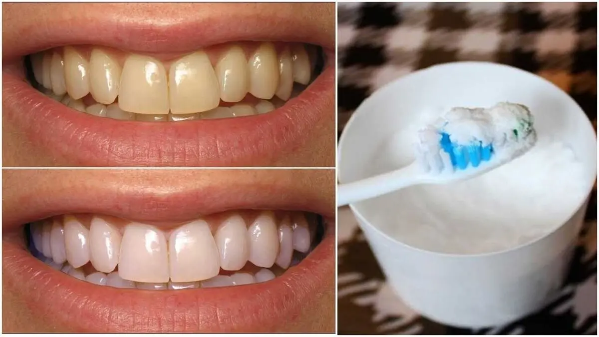 Whiten-Teeth-With-Baking-Soda-www.koorook.com-7