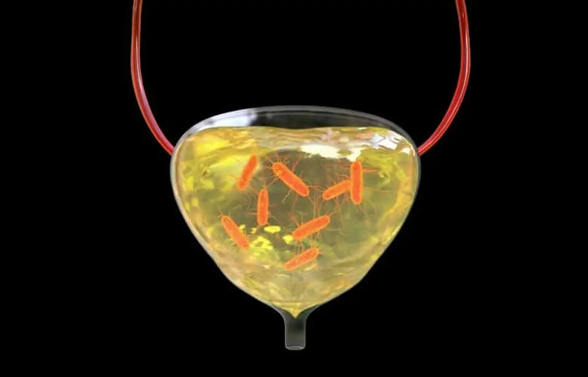 Bladder-vaghtesobh