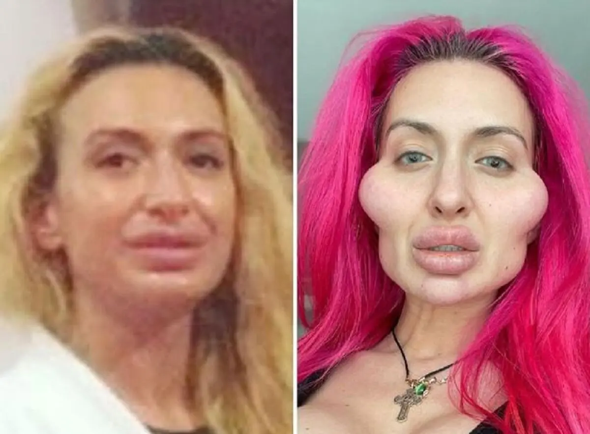 1_transformation