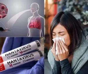 هانتاویروس از چه حیوان و کشوری متولد شد و چقدر مرگ و میر دارد؟ به ایران رسیده؟