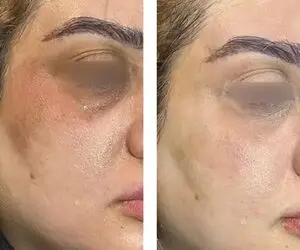 چگونه پوستی روشن تر و شفاف تر داشته باشیم؟ معرفی بهترین محصولات مراقبت از پوست