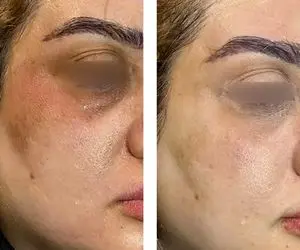 چگونه پوستی روشن تر و شفاف تر داشته باشیم؟ معرفی بهترین محصولات مراقبت از پوست
