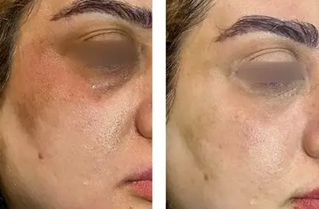 چگونه پوستی روشن تر و شفاف تر داشته باشیم؟ معرفی بهترین محصولات مراقبت از پوست