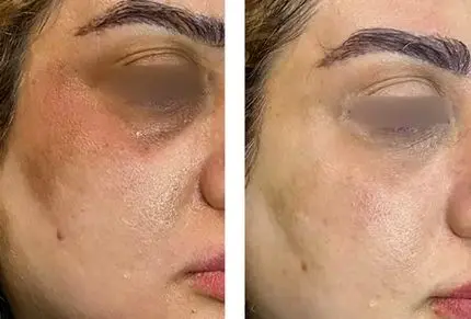 چگونه پوستی روشن تر و شفاف تر داشته باشیم؟ معرفی بهترین محصولات مراقبت از پوست