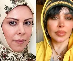 فلور نظری تو لایو زیر و روی زندگیشو ریخت بالا؛ از شوهرِ نداشته تا زندگی سالم ولی پروتزی