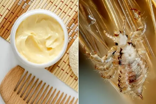 از بین بردن شپش سر با سس مایونز؛ مدل خاص شونه کردن رو هم که نابودشون میکنه گفتم