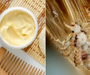 از بین بردن شپش سر با سس مایونز؛ مدل خاص شونه کردن رو هم که نابودشون میکنه گفتم