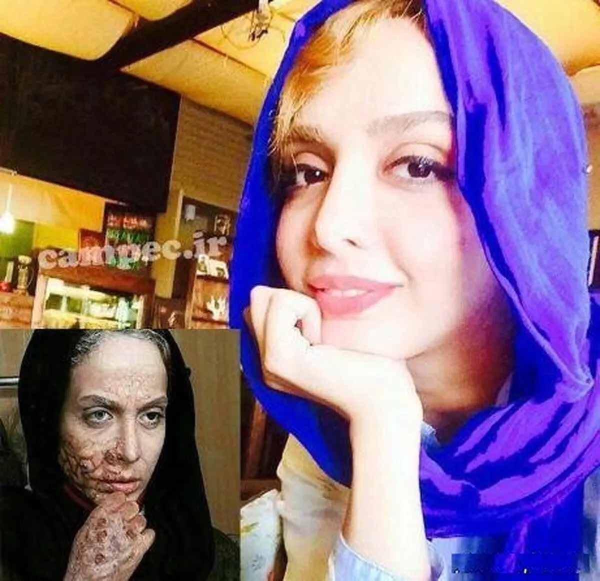 المیرا-دهقانی