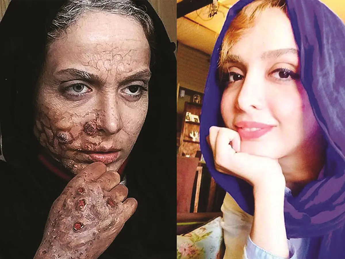 المیرا دهقانی بازیگر