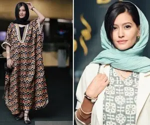 "پردیس احمدیه" بعد پوست شیر چال گونه کاشته قد چاه؛ خانوم پرستیژ داره شخصی و شیک!