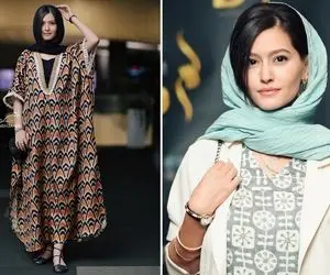 "پردیس احمدیه" بعد پوست شیر چال گونه کاشته قد چاه؛ خانوم پرستیژ داره شخصی و شیک!