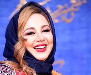 عکس/ دندان های لمینت بهنوش بختیاری