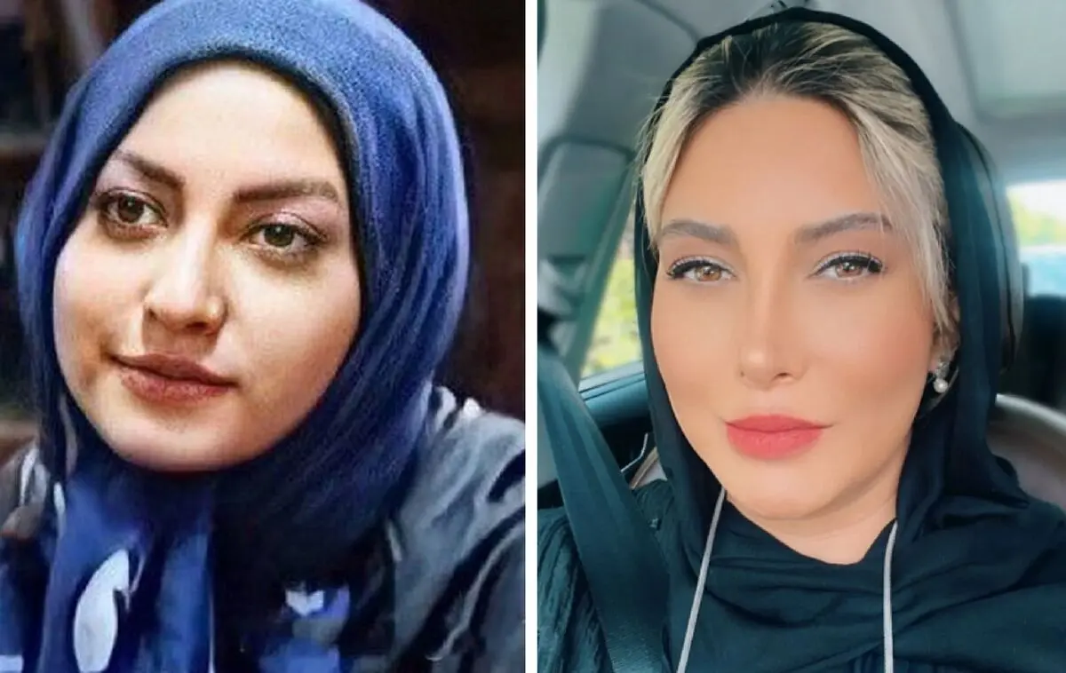 rgvs