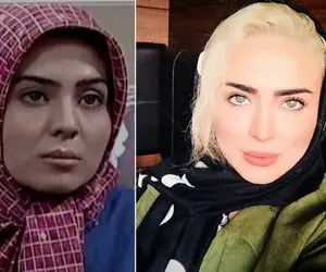 زندگی سوپر اروپایی "سولماز آقمقانی" که بهشت براش کمه؛ خانوم قرنیه اش هم پروتز کرده!