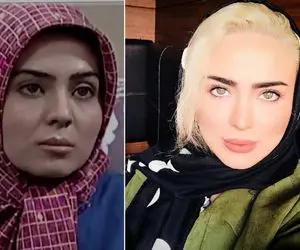 زندگی سوپر اروپایی "سولماز آقمقانی" که بهشت براش کمه؛ خانوم قرنیه اش هم پروتز کرده!