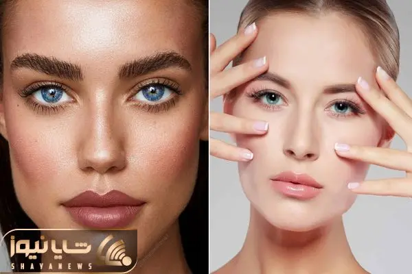 آر اف چیست؟