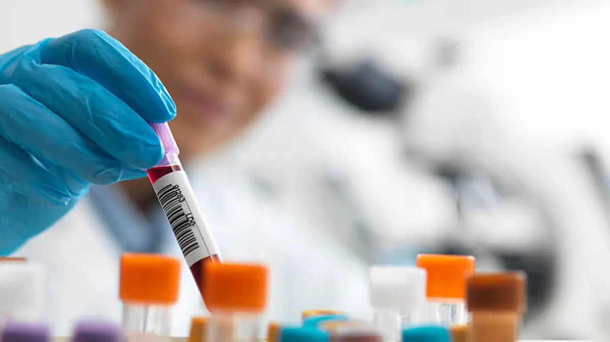 female_testing_blood_sample