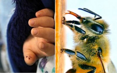 مرگ تلخ مستانه شاهپری دانش آموز خوزستانی بر اثر نیش زنبور